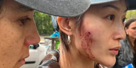 Berlin: Angriff auf ein queeres DJ-Paar