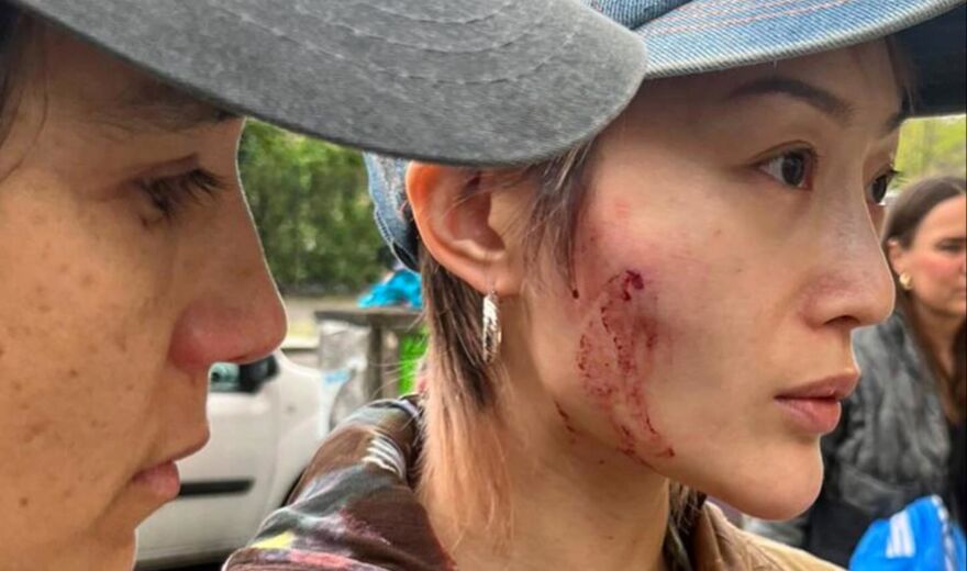 Berlin: Angriff auf ein queeres DJ-Paar